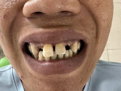 Hình Ảnh Làm Răng Tại Nha Khoa Tâm Phúc